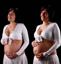 Pregnancy Concerns: Skin Changes