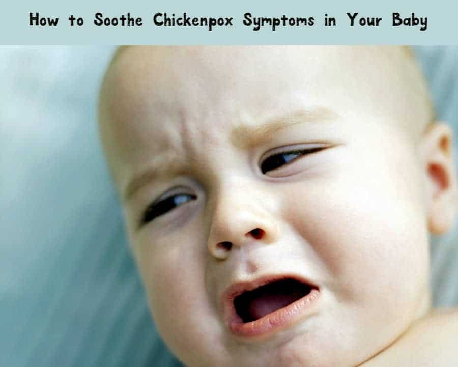 How do you soothe chickenpox in a baby? Check out our tips to help your tiniest tot make it through the worst of the virus!